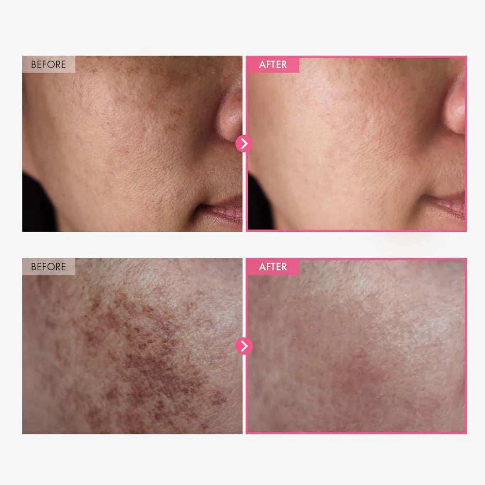 |BUY 1 GET 1 FREE|   Arencia Vitamin C Booster Shot + TOSOWOONG Arbutin 7% + Tranexamic Acid 4% Cream