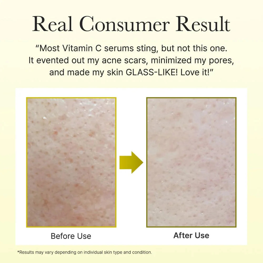 |BUY 1 GET 1 FREE|   Arencia Vitamin C Booster Shot + TOSOWOONG Arbutin 7% + Tranexamic Acid 4% Cream